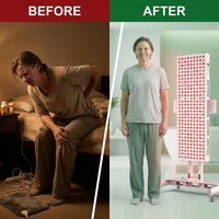 Red Light Therapy Device with Stand - Moving Pro Series Professional Edition — Before & After